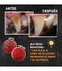 Qchefs Dental Snack Granulado Perro 90 grs