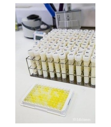 Diagnóstico De Gestación En Leche