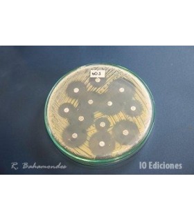 Análisis Microbiológico De Leche (Cultivo) Y Antibiograma