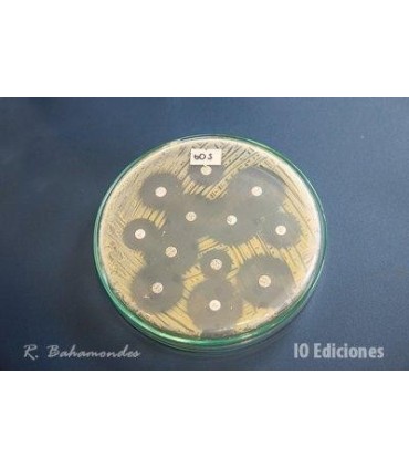 Análisis Microbiológico De Leche (Cultivo) Y Antibiograma